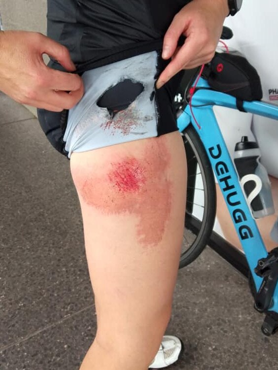 Torquay cyclist Claire Breed was hit by a truck.