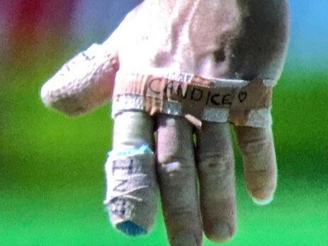 A close-up of David Warner’s taped-up left hand during the second Test against South Africa last year. Picture: Getty Images