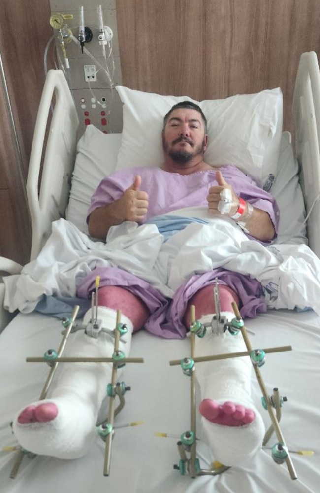 Jason was working on a client's garden when he fell through a roof landing on both ankles, shattering them. He is looking at six months recovery. Photo supplied by Lisa Adams