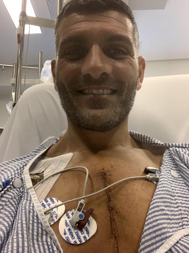 Socceroos great John Aloisi six days after open heart surgery in November 2019. Picture: Supplied