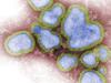 FAQ: Queensland’s horror influenza wave explained