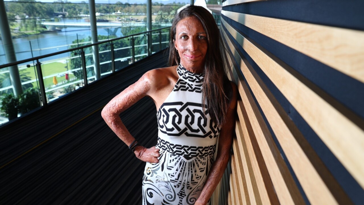 Permission To Quit Fire Survivor Turia Pitts New Years Podcasts The Courier Mail