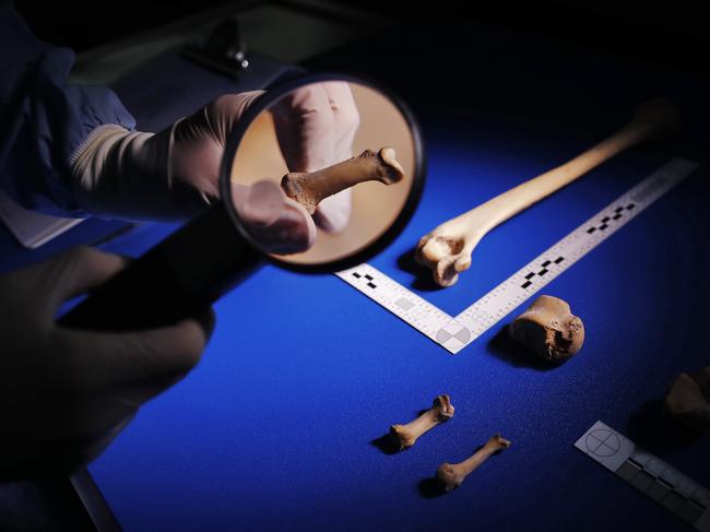 Dr Jack Garland, Forensic Pathologist at NSW Health Pathology Forensic and Analytical Science Service inspecting human remains. Picture: Sam Ruttyn