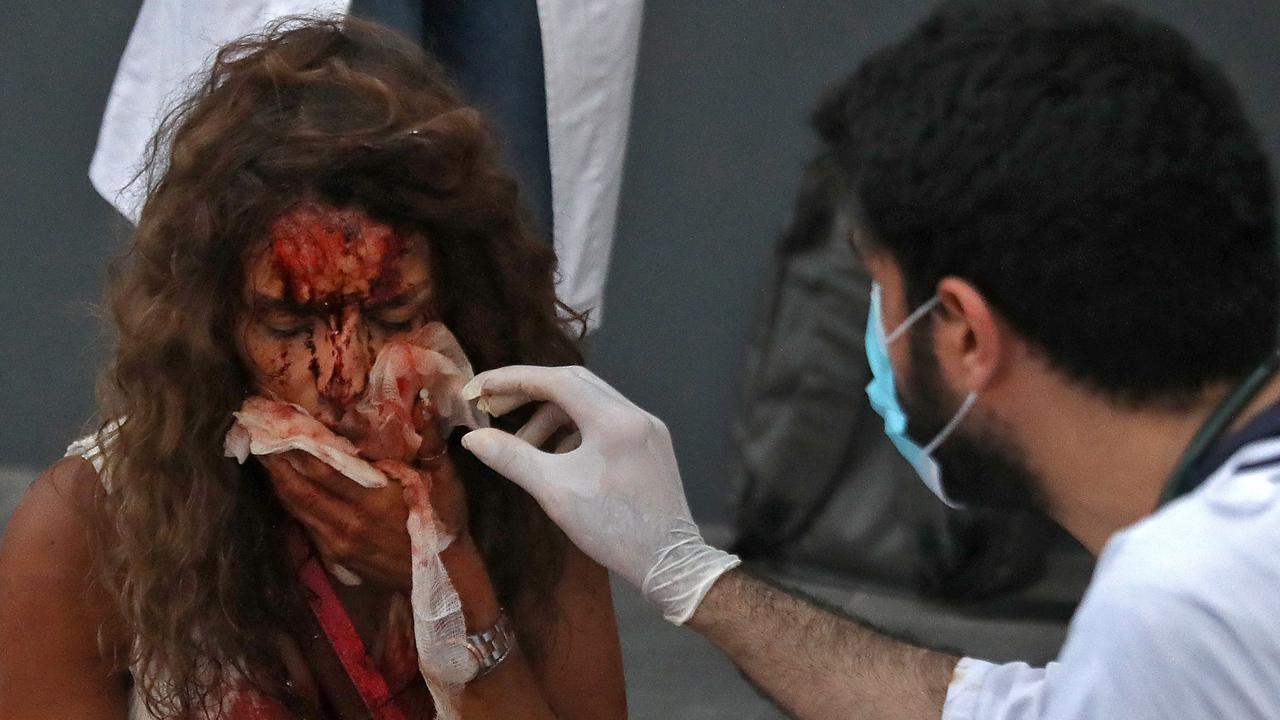 A medic tends to the injuries of a woman outside a hospital following an explosion in the Lebanese capital Beirut. Picture: Ibrahim Amro/AFP