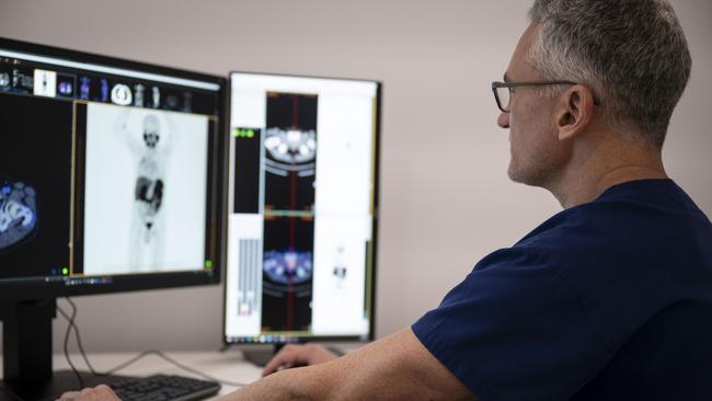 A physician examines scans from a patient with prostate cancer. Picture: Supplied