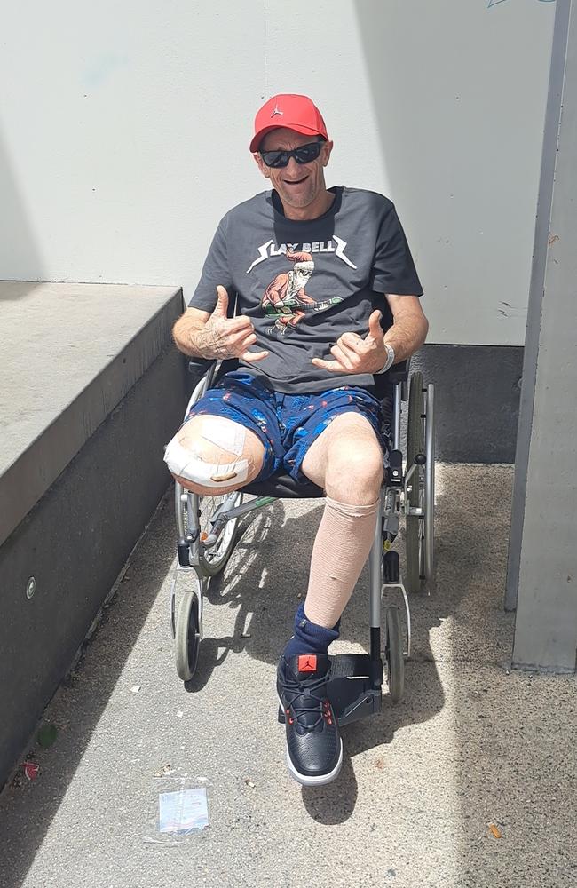 Campbell Town man Ricky Blyth, 41, says he wants to turn his life around after losing his leg in a stolen motor vehicle accident. Picture: Alex Treacy