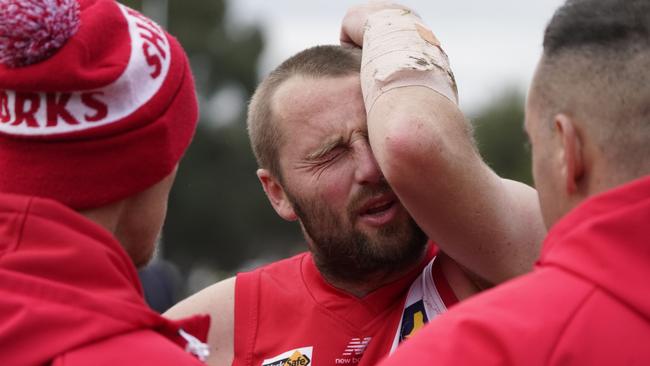 Sorrento coach Leigh Poholke has suffered a PCL injury. Picture: Valeriu Campan