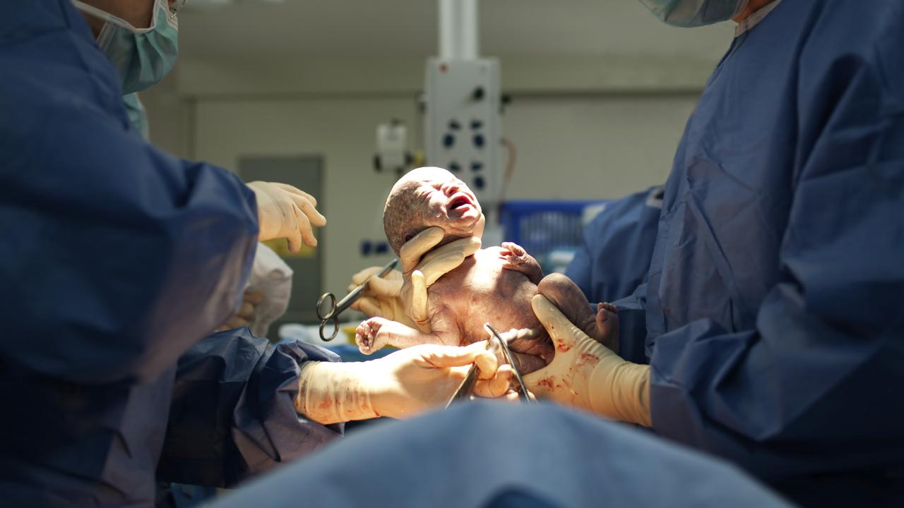 COST OF HAVING A BABY – Baby being born via Caesarean Section