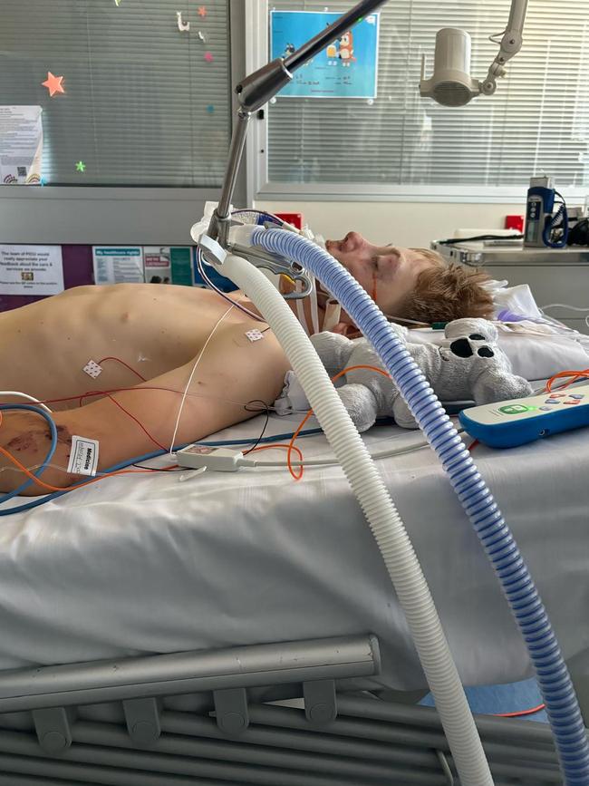 14-year-old Jack Evans-Wood in ICU. Picture: Supplied