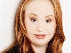 Madeline Stuart is looking to launch a career in modelling. Photo: SUPPLIED