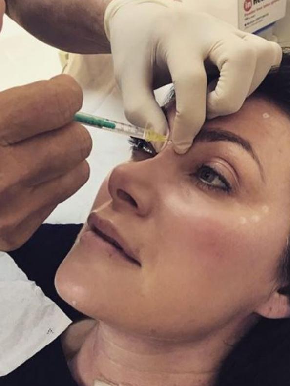 Lisa Oldfield shares a Botox selfie. Picture: Instagram,