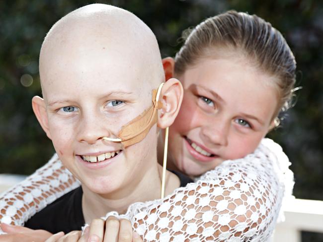 5/10/17 (LR) Jack Bartlett (11) wit his sister who is giving him life saving bone marrow, Ava Bartlett (9) and who she is having a bone marrow transplant with, pictured at their home in Seaforth. Adam Yip/ Manly Daily