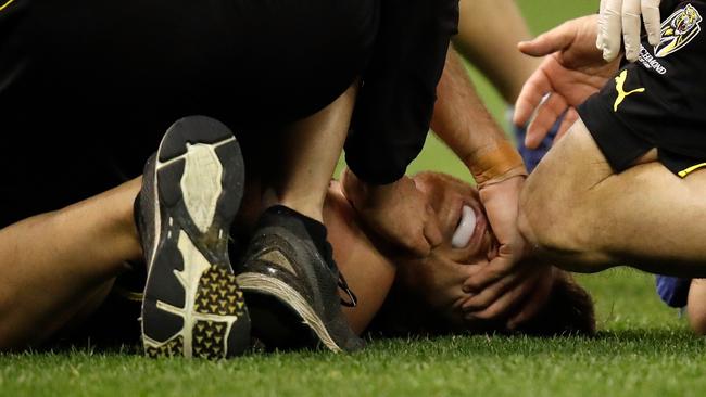 Reece Conca in agony after injuring his ankle against the Swans.