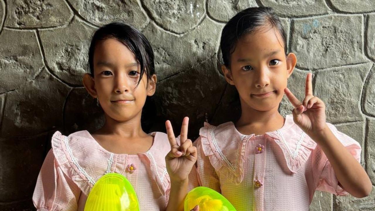 Previously conjoined twins, Nima and Dawa have celebrated their 7th birthday Picture: Facebook