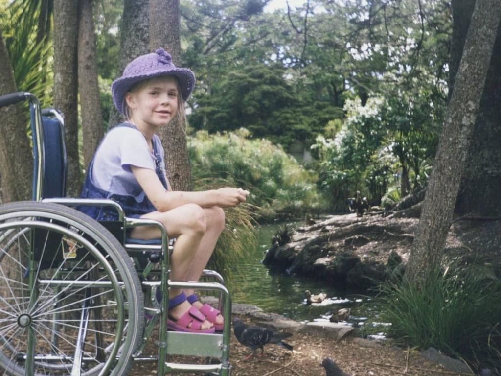 Positive Handicapped Woman Bending To Prosthetic Leg by Stocksy