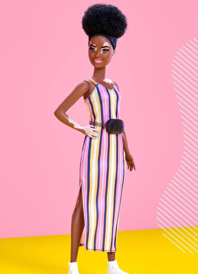 barbie with vitiligo