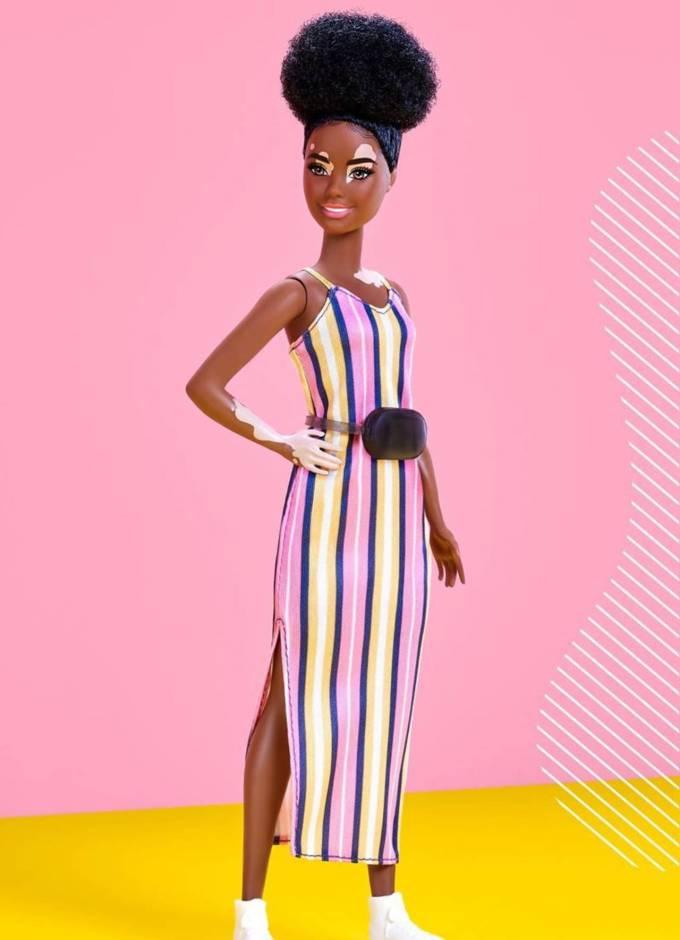 Barbie with vitiligo online