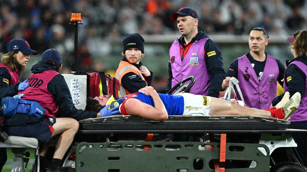 Brayshaw being stretchered off after the hit. (Photo by Quinn Rooney/Getty Images)