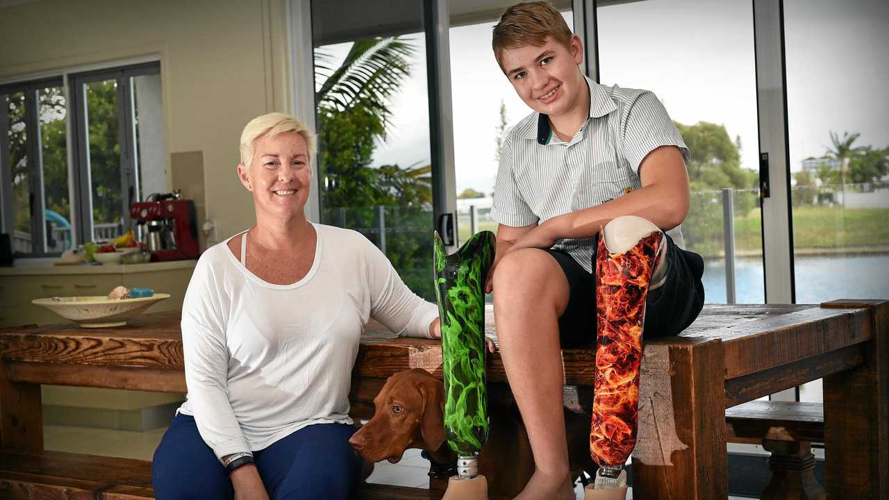 BIG DAY: Kane Bilton, 14, has just received his custom-made prosthetic leg. Kane with his mother Tess Bilton. Picture: Patrick Woods