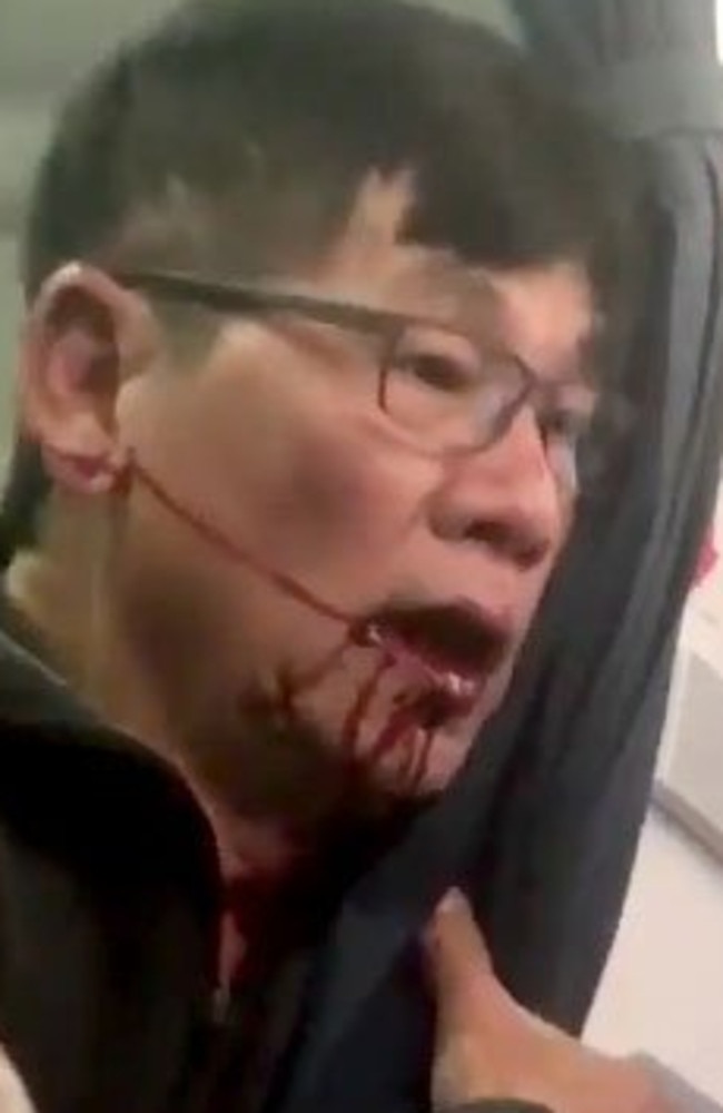 The bloodied and distressed man from the video another passenger took of him being dragged bodily from a United Airlines flight has caused an uproar.