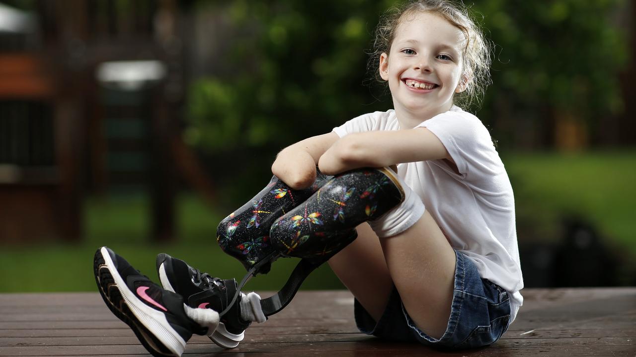 Mia Wilkinson, 8, wearing her eighth set of prosthetic legs, decorated with dragon flies. Picture: Josh Woning