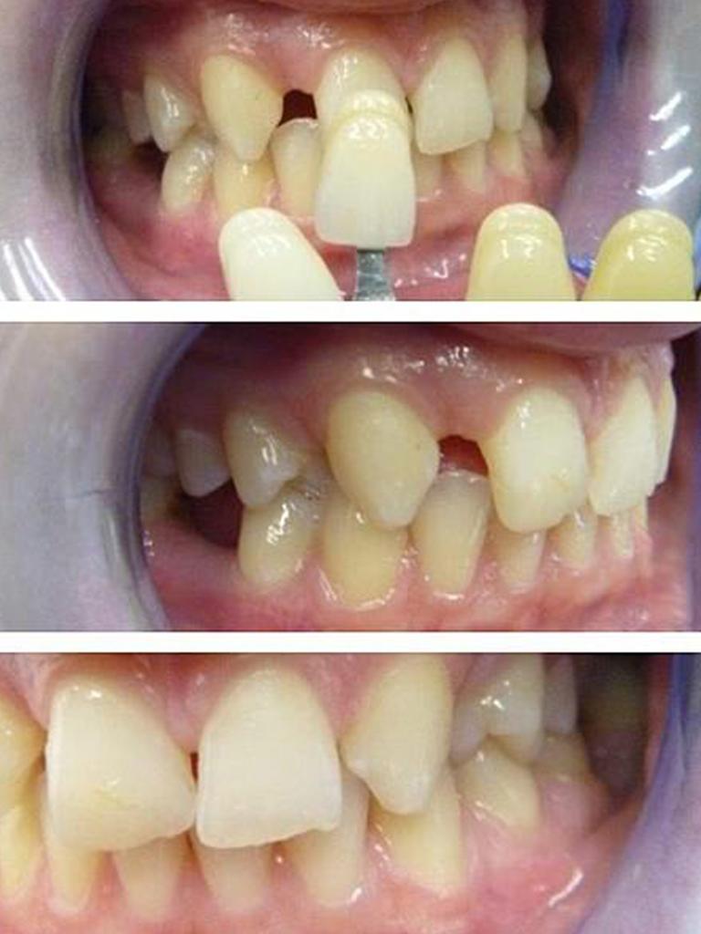 Her dental surgery shared her before and after photos. Picture: Maven Dental Yokine/Instagram