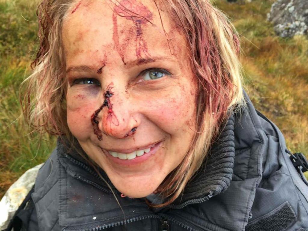 Magdalena Michalowska smiles for the camera after her fall, not realising how injured she really was. Picture: Deadline News