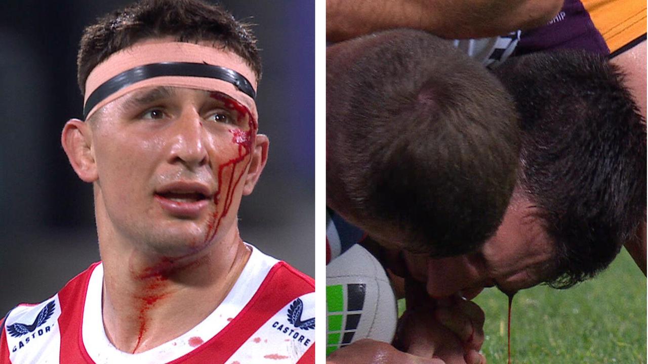 Roosters question Radley treatment after dramatic win