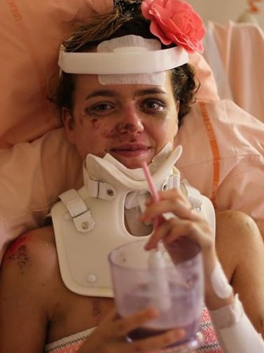 Adelaide Stratton, 25, of Freshwater, back in 2016, when she was in hospital following the Nice terror attack. Picture: @adelaidestratton, Instagram.