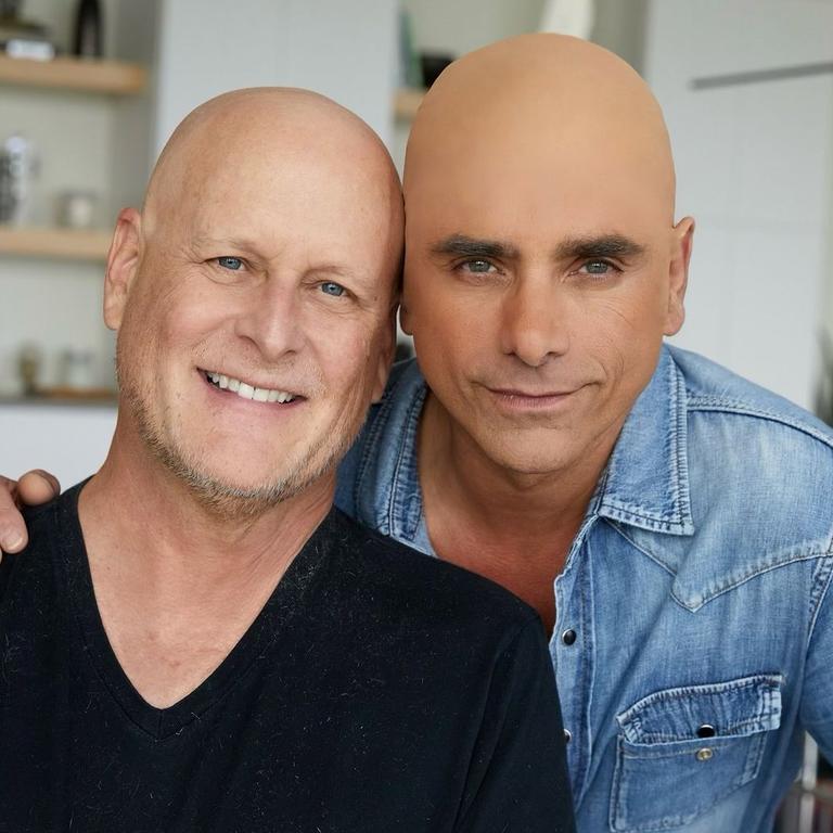 John Stamos called out for wearing 'bald cap'.