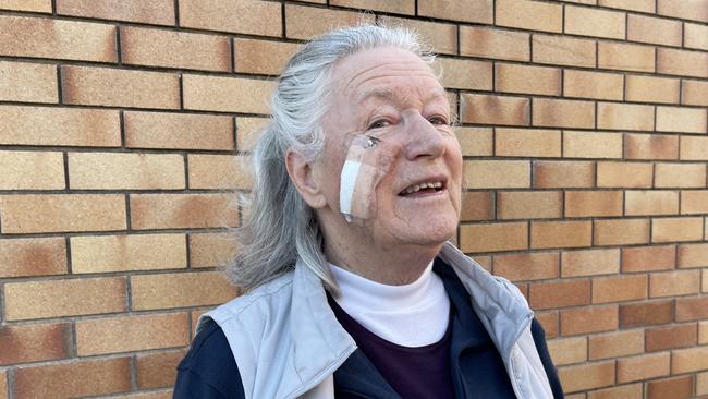 Marcia Murray said she “laid low” after the removal of her malignant cancer. Photo: Madison Mifsud-Ure / Stanthorpe Border Post