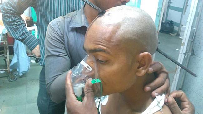 Man survives after skull speared by rod