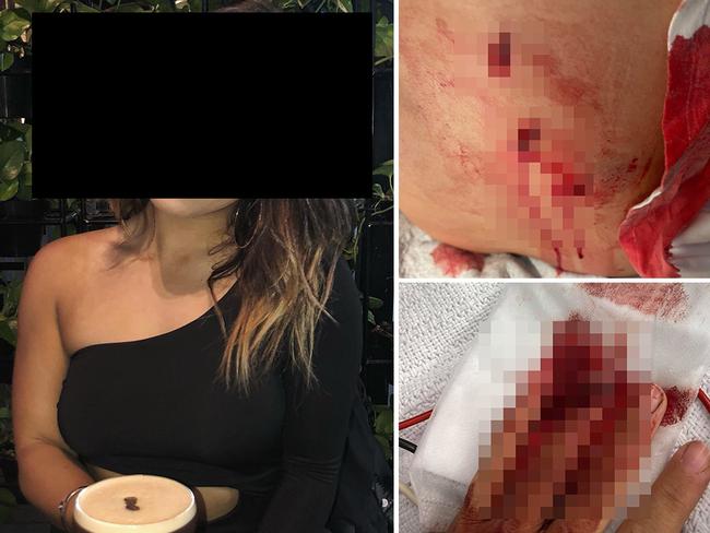 web Jogger stabbed attacker stalked