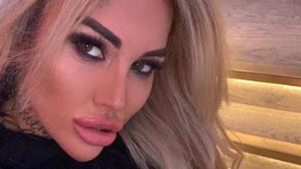 Botched: Reality star Sallie Axl asks for plastic surgery heel implants ...