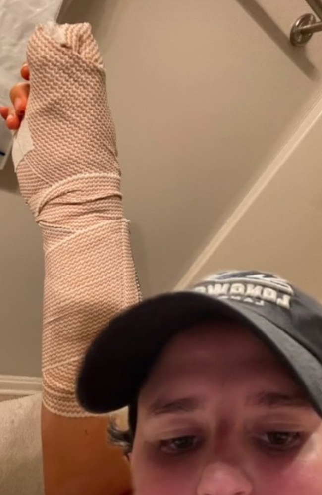 Maria woke up from surgery to see her hand and arm bandaged. Picture: TikTok/invrfoundwaldo