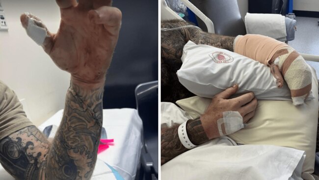 Elliott was given two bags of emergency blood before undergoing life-saving surgery. Source: Courier Mail