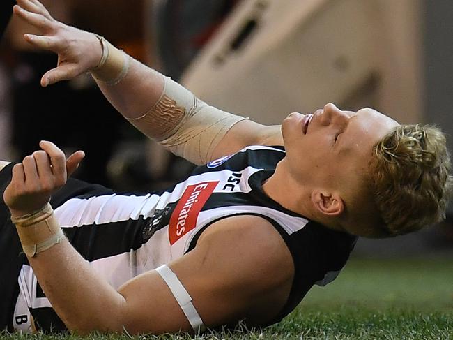 Adam Treloar of the Magpies is seen after sustaining an injury during the Round 14 AFL match between the Collingwood Magpies and the Carlton Blues at the MCG in Melbourne, Sunday, June 24, 2018. (AAP Image/Julian Smith) NO ARCHIVING, EDITORIAL USE ONLY