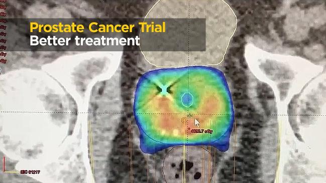 Prostate cancer trial: Better treatment