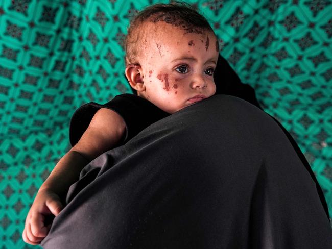 Palestinian toddler Rim Abu Hayya, the sole survivor from her family after they were killed by reported Israeli bombardment that hit their house in the east of Khan Yunis. Picture: AFP