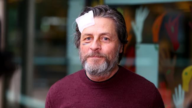 Adelaide man Keith Davis who was injured on the Singapore Airlines turbulence flight, at the Royal Adelaide Hospital were his wife Kerry Jordan is continuing her treatment for spinal injuries Picture: NewsWire / Kelly Barnes