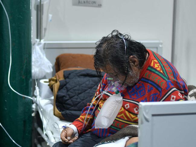 (FILES) In this file photo taken on June 18, 2021 a patients sits on the bed at the Covid-19 specialized ward at the Honorio Delgado Hospital in Arequipa, Peru, following the sprouting cases of the deathly Delta strain. - The Peruvian government extended on July 11, 2021 for one more month the state of emergency which started 16 months ago due to the COVID-19 pandemic. (Photo by Diego Ramos / AFP)