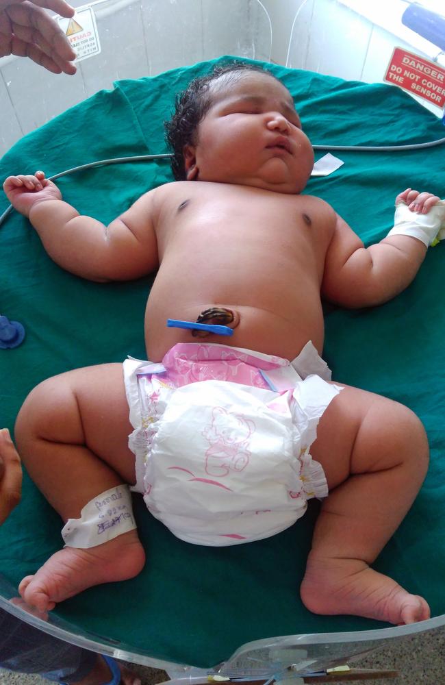 The size of the unnamed baby girl left medics baffled. Picture: CATERS.