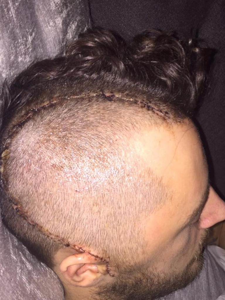 Ryan Mason's shocking head injury.