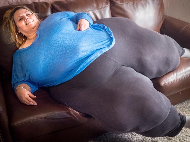 Woman wants the world’s biggest hips