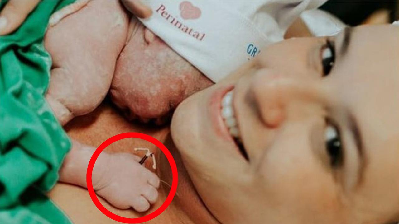 Baby born 2024 holding iud