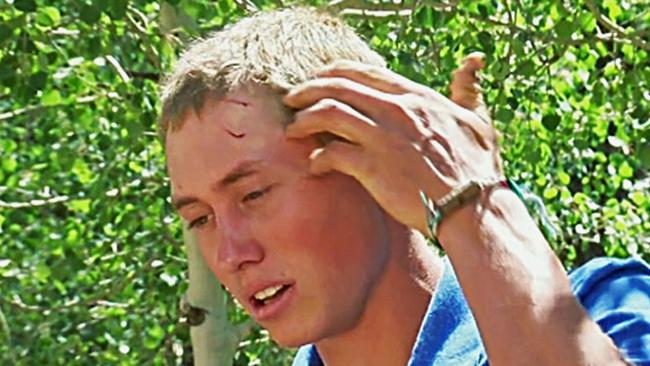 A teen staffer at a US Colorado camp, who gave only his first name, Dylan, describes how he fought off a bear after waking up to find the animal biting his head and trying to drag him away on Sunday, July 9, 2017. Picture: KMGH-TV via AP.