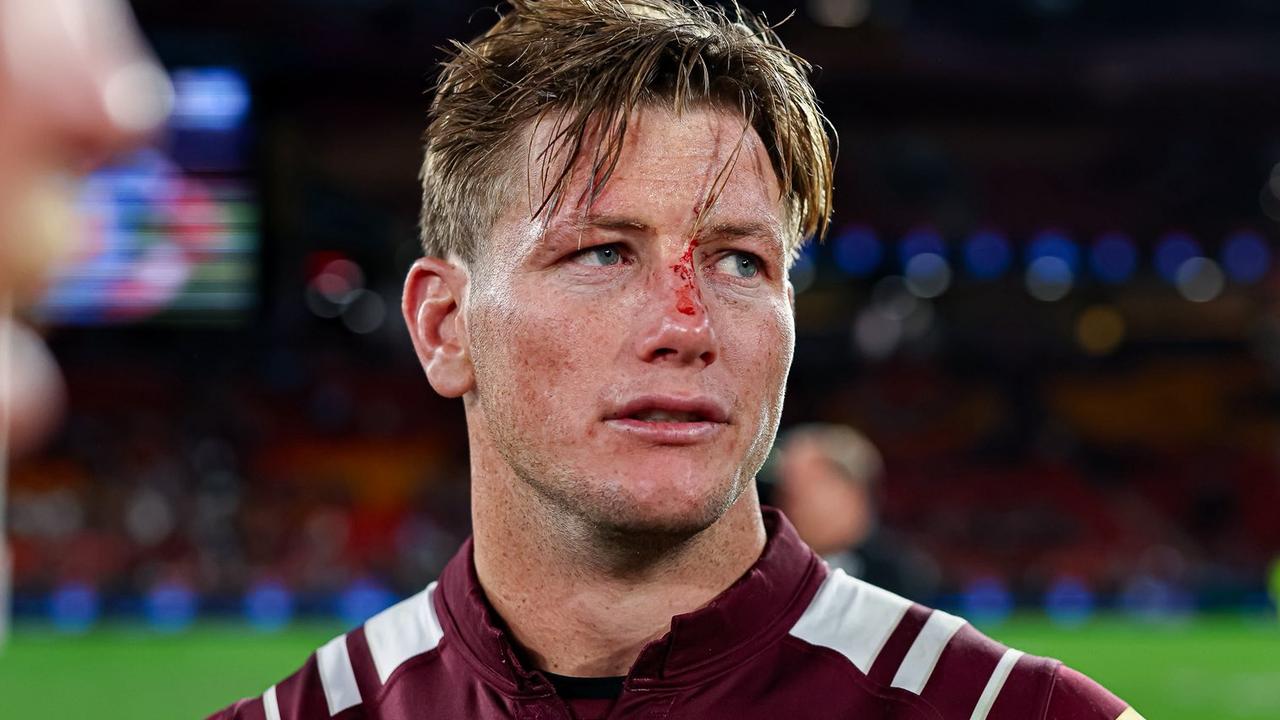 ‘Doubtful’: Storm pays Origin toll
