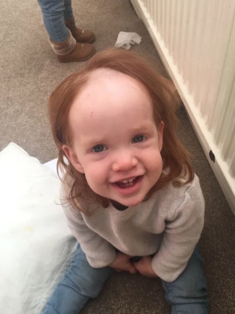 The toddler was left looking like Pennywise the Clown. Picture: Kennedy News