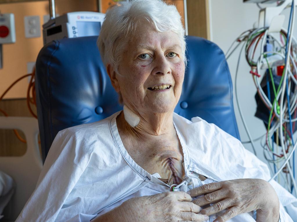 Judith Stone is one of 1500 Victorians to have had open heart surgery at the Victorian Heart Hospital. Picture: Jason Edwards
