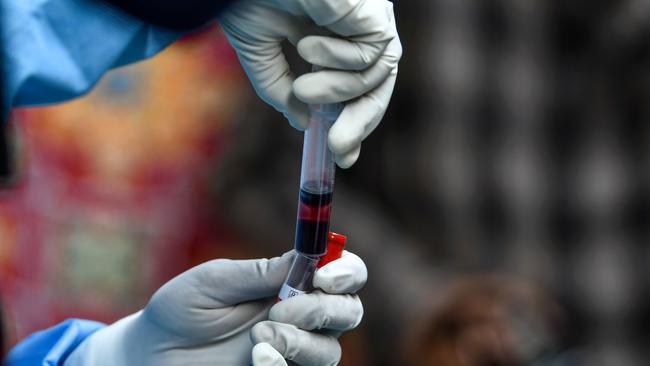 A team from the Royal Melbourne Hospital health start-up Immunosis has developed a test capable of diagnosing the conditions from a blood sample. Picture: AFP